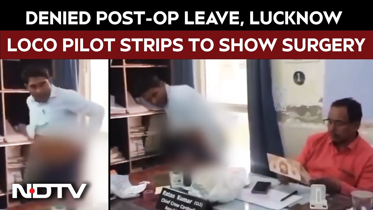 Lucknow News | Denied Post-Op Leave, Lucknow Loco Pilot Strips To Show Surgery Stitches