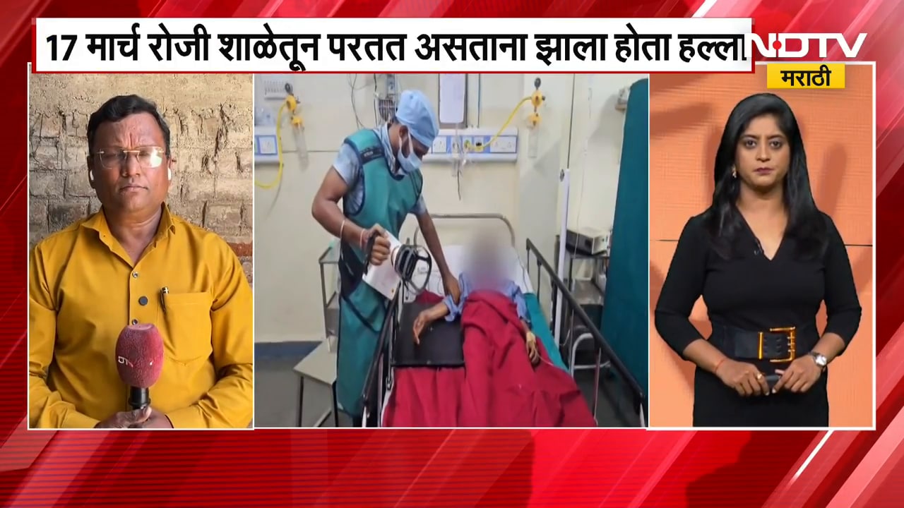 Sangamner | शाळकरी मुलीवर अॅसिड हल्ला प्रकरण,  13 दिवसानंतरही आरोपी मोकाट | NDTV मराठी