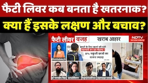 Fatty Liver Disease: फैटी लिवर कब बनता है खतरनाक? क्या हैं इसके लक्षण और बचाव?