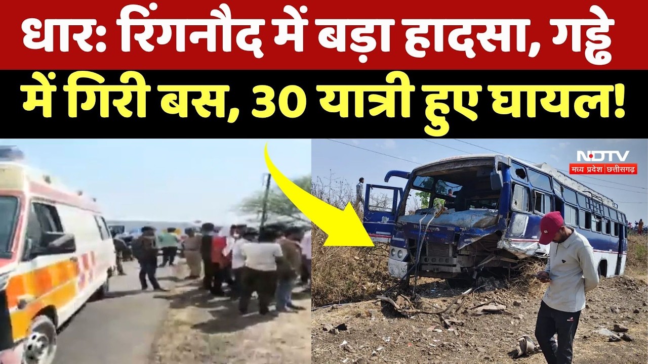 Dhar Bus Accident: रिंगनौद में Toll Tax के पास गड्ढे में गिरी बस, 30 यात्री घायल | MP News |Breaking