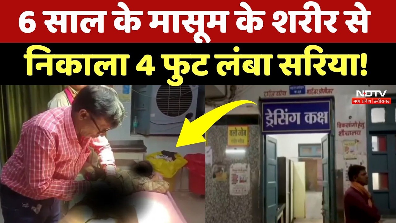 Satna Medical College: 6 साल के मासूम के प्राइवेट पार्ट में घुसा सरिया, ऐसे बचाई जान!