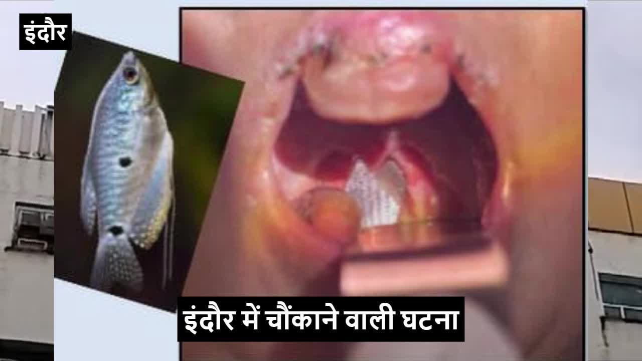 एक्वेरियम की हो रही थी सफाई, मछली उछल कर बच्चे के गले में फंसी, देखें फिर क्या हुआ...