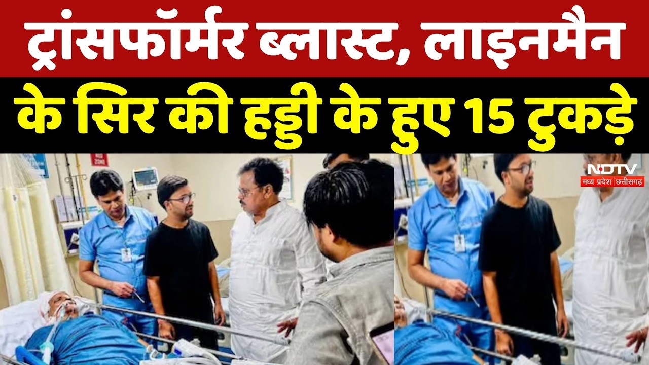 Gwalior में Transformer Blast, Lineman के सिर की हड्डी के हुए 15 टुकड़े