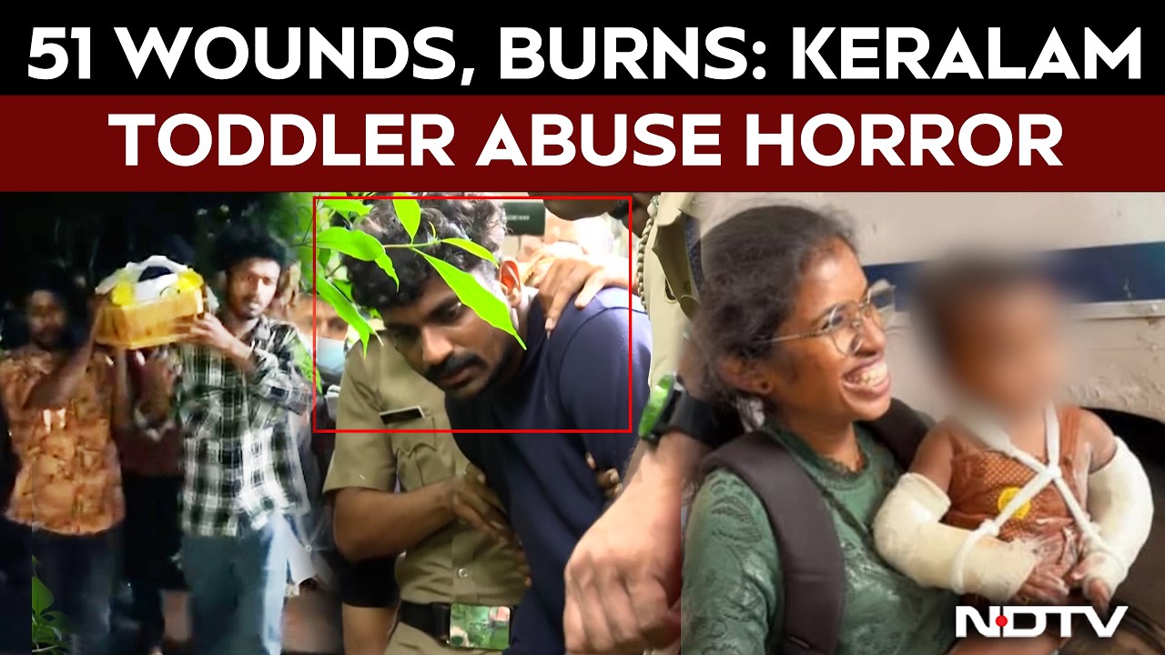 Kerala News | 51 Wounds, Cigarette Burns: Kerala Toddler Abused For A Month