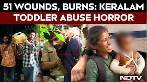Kerala News | 51 Wounds, Cigarette Burns: Kerala Toddler Abused For A Month