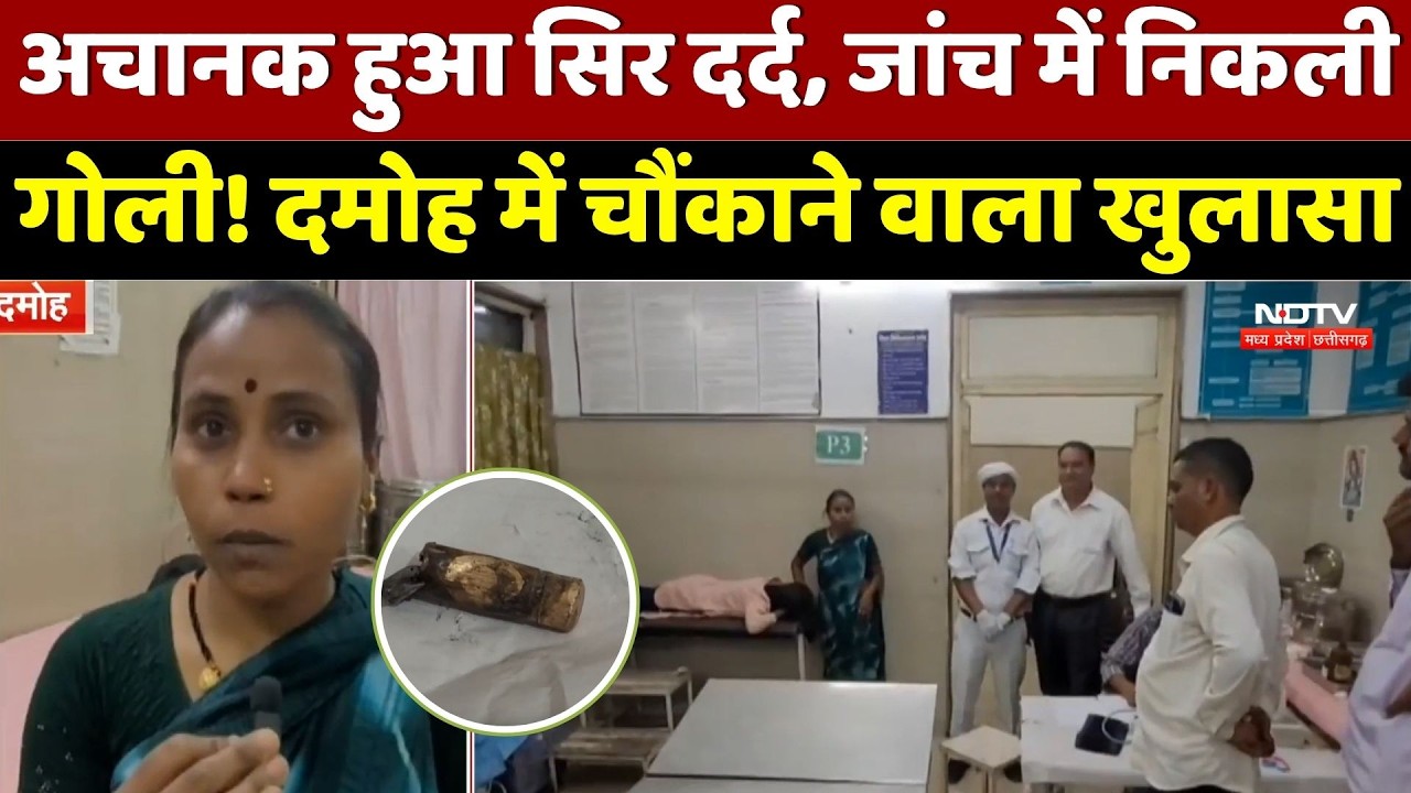 Damoh News : सिर में फंसी थी Revolver की गोली, युवती को महीनों तक नहीं चला पता!