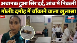 Damoh News : सिर में फंसी थी Revolver की गोली, युवती को महीनों तक नहीं चला पता!