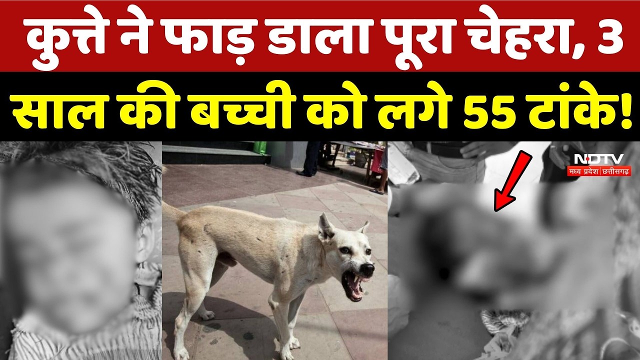 Agar-Malwa Dog Attack: कुत्ते ने फाड़ डाला पूरा चेहरा, 3 साल की बच्ची को लगे 55 टांके!