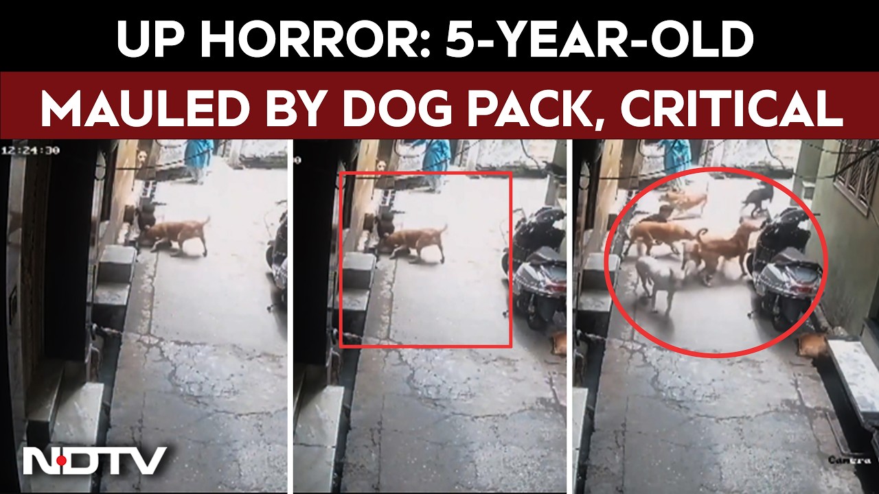 Uttar Pradesh Horror: 5-Year-Old Mauled By Dog Pack, Critical