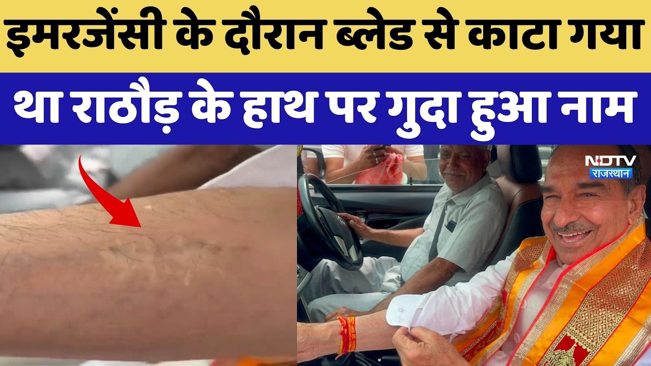 Jaipur: Emergency के दौरान ब्लेड से काटा गया था Madan Rathore के हाथ पर गुदा हुआ नाम
