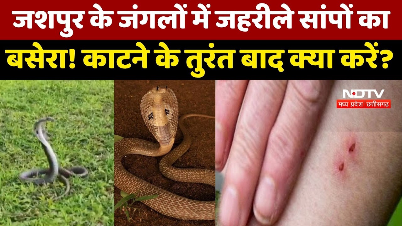 Jashpur Snake News: जशपुर के जंगलों में जहरीले सांपों का बसेरा! काटने के तुरंत बाद क्या करें?। Top
