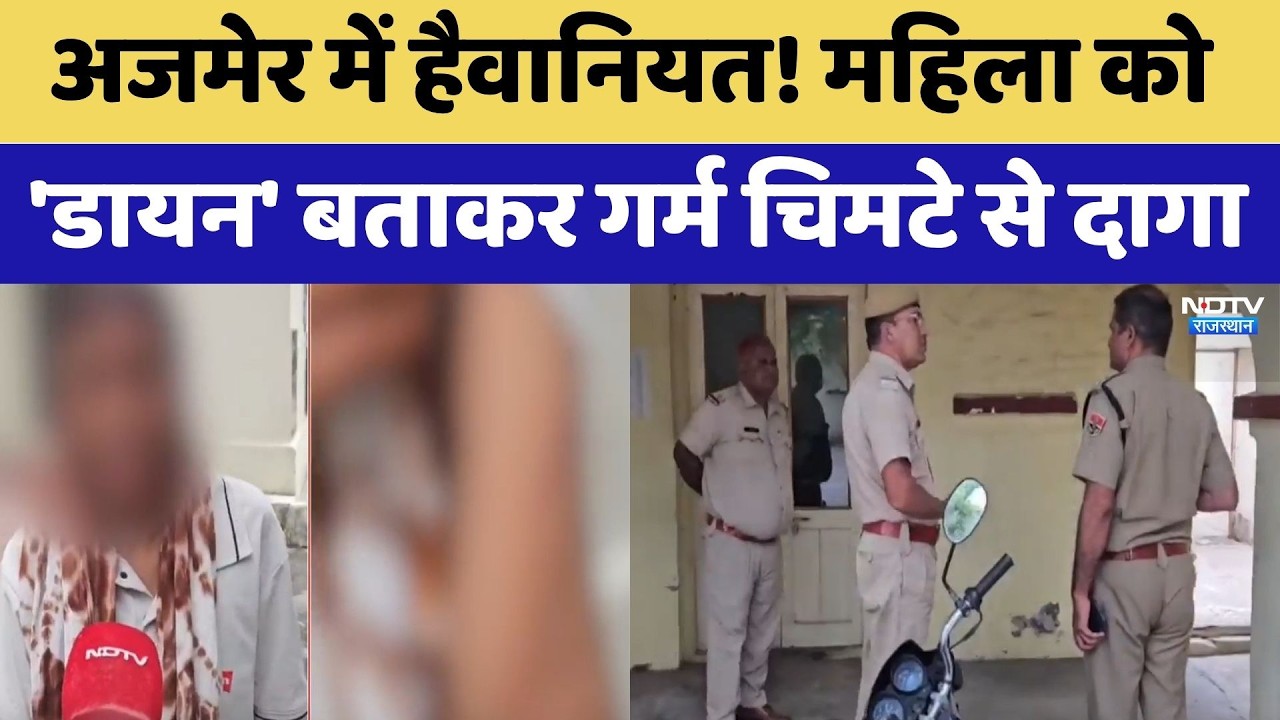 Ajmer में हैवानियत! महिला को 'Dayan' बताकर गर्म चिमटे से दागा | Top News