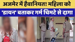 Ajmer में हैवानियत! महिला को 'Dayan' बताकर गर्म चिमटे से दागा | Top News