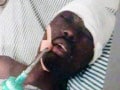 Video : African student beaten, stoned in Jalandhar; in coma for 3 months