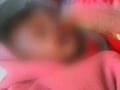 Video : In Bikaner, father bites off his baby's nose, lips and cheeks in a fit of rage