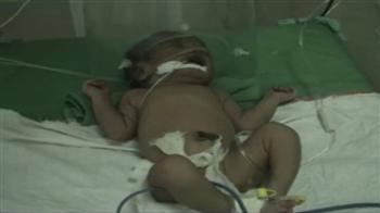 Videos : नवजात बच्चों की मौत जारी