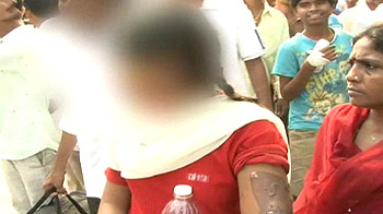 Teen was tortured with clothes iron