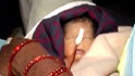 Infant dies in Hepatits-B-hit Modasa