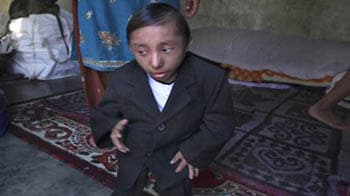 Video : World's shortest man from Nepal