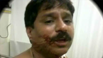 'चिंटू के जख्म गोली के नहीं'