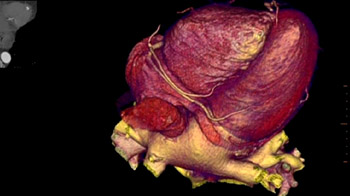 Latest technology improves diagnoses in heart patients