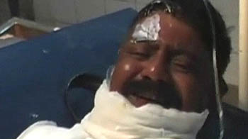 कॉन्स्टेबल को जिंदा जलाने की कोशिश