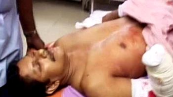 Gang cuts off Kerala lecturer's hand Gang cuts off Kerala lecturer's hand