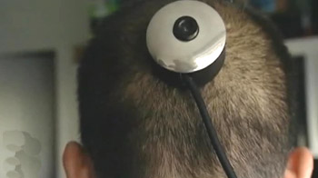 New York professor gets a third eye