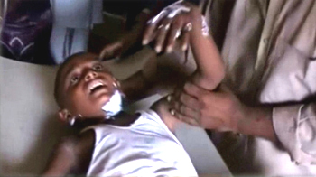 स्कूलवैन में आग लगने से बच्चे झुलसे