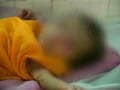 Videos : थैलीसीमिया : एक गंभीर बीमारी