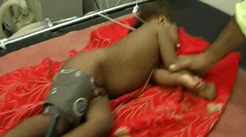 Encephalitis leaves 200 dead in Gorakhpur