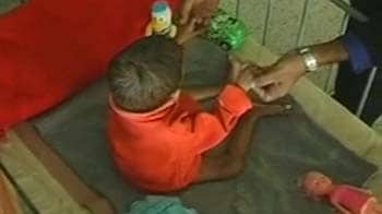 Video : HIV stigma: 4-year-old girl child starved, abandoned