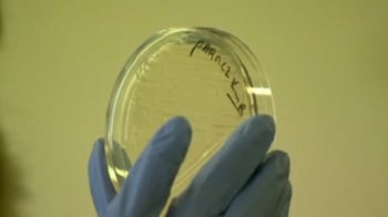 Video : Government says superbug not linked to India