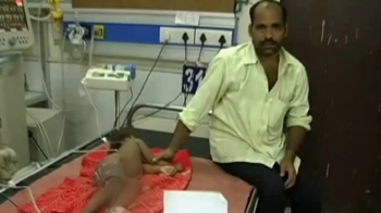 Encephalitis in Gorakhpur: 17 dead in 3 days Encephalitis in Gorakhpur: 17 dead in 3 days