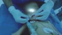 Delhi infant survives needle in the eye