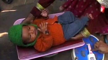 Video : Malnutrition hits the heart of Delhi