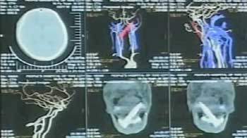 A knife in his jaw for years, but he had no clue