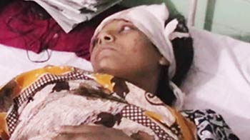 Attacked on train, she lost her leg