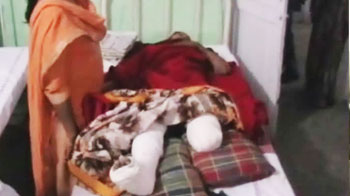 Volleyball player thrown out of train, loses leg