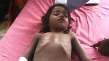 Video : Encephalitis alert in Bihar: 17 dead in 2 weeks