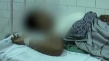 Video : Uttar Pradesh: Dalit girl immolates herself, BSP leader booked