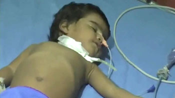 Infant survives after swallowing one-foot metal rod