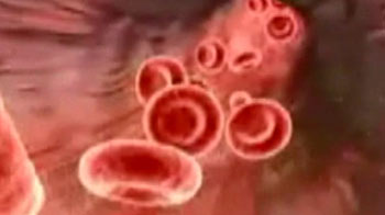 सुपरबग के मुद्दे पर होगी बैठक