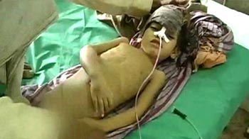 Encephalitis kills 376 kids, eastern UP worst affected