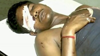 Videos : रंजिश में युवक की आंख निकाल ली