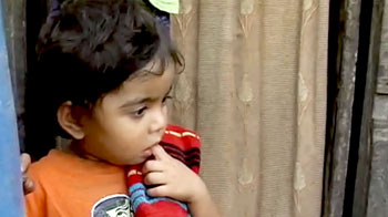 झुग्गी के 60 फीसद बच्चे कुपोषण का शिकार