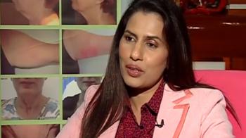 Lipo, nose jobs for brides and grooms