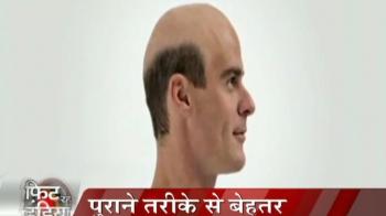 निजात गंजेपन से...