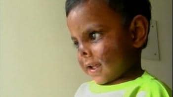 Video : Bangalore's baby: Strangers helped him live and see