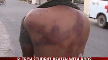 Noida ragging: Student beaten up with rods Noida ragging: Student beaten up with rods